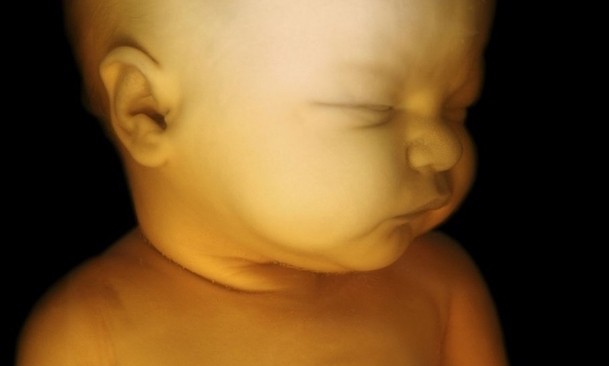 Abortion holds even less weight in the age of reason and modern science where the evidence for human life, from the beginning, is incontrovertible.